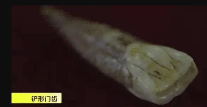 发现了"铲形门齿"的特征,而万年之后的今天中国人依然保留着这个特征