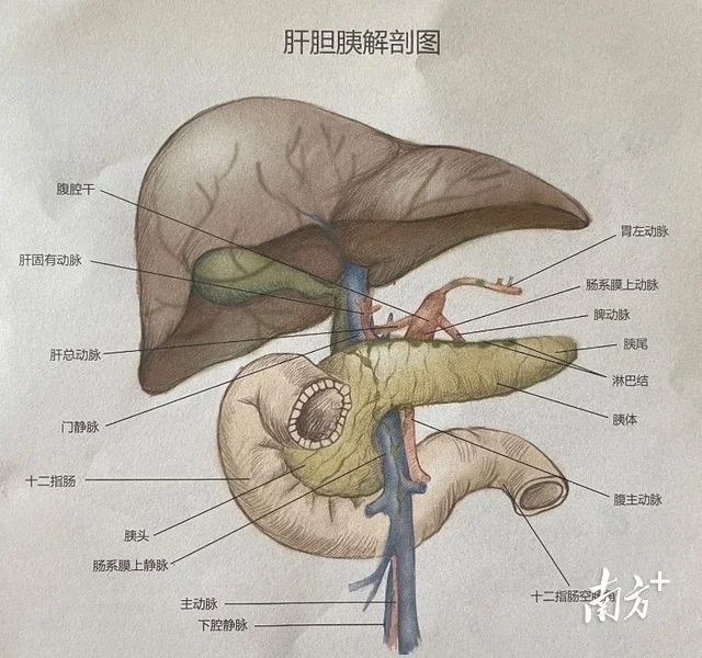 胰头癌图片位置示意图图片